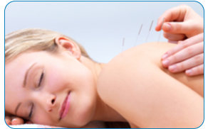 FAQ-dryneedling-1_2